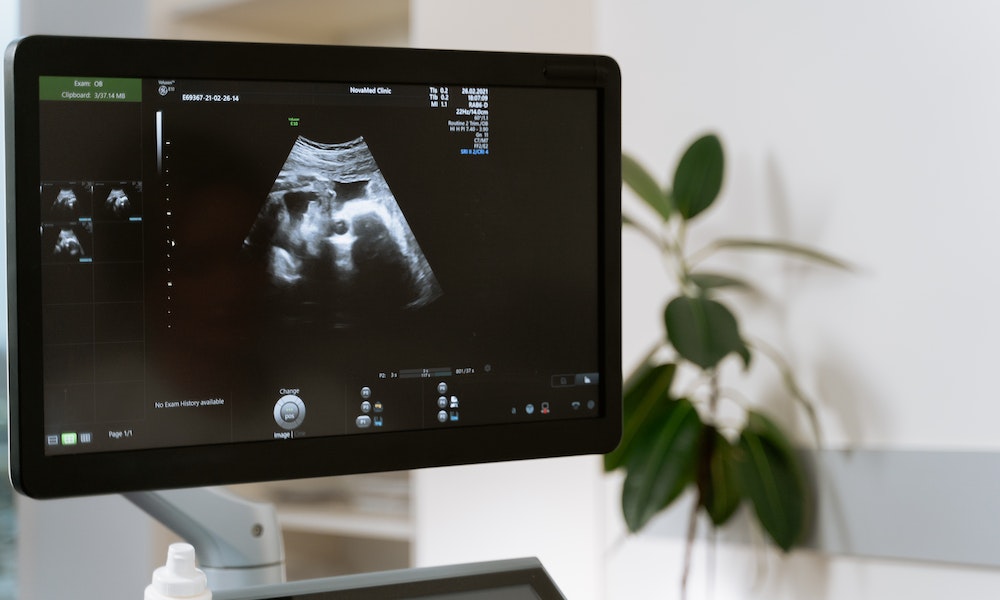 ultrazvuk-ekran